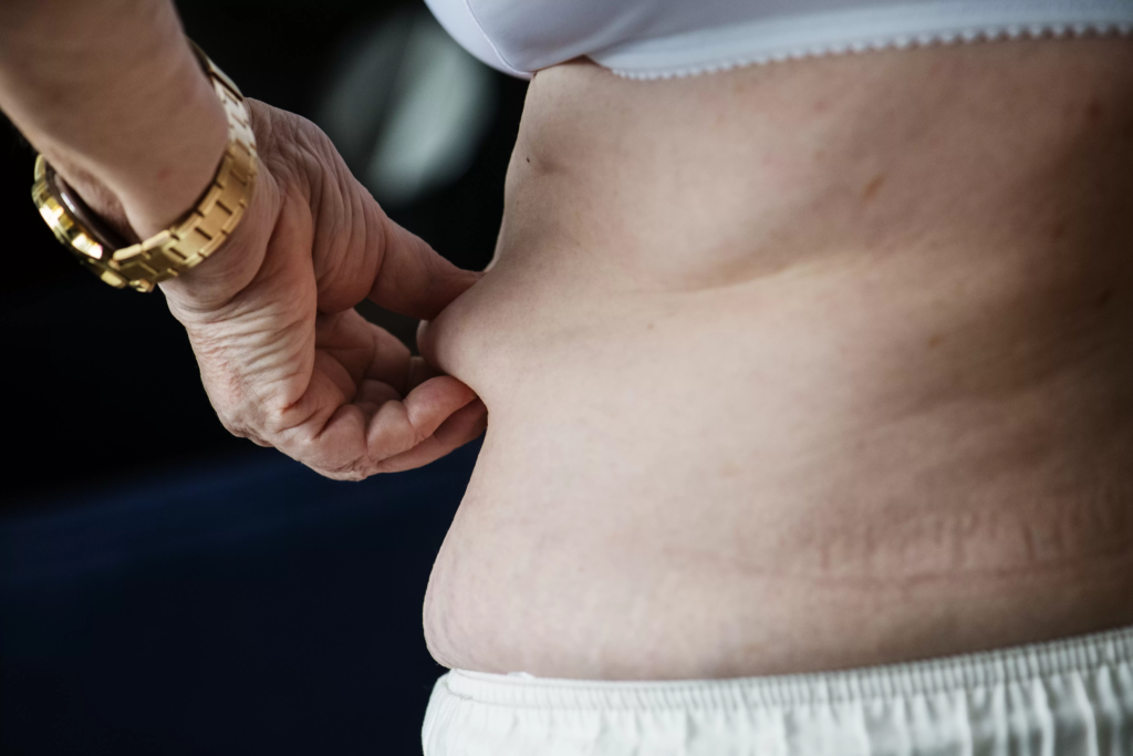 closeup-obese-elderly-woman