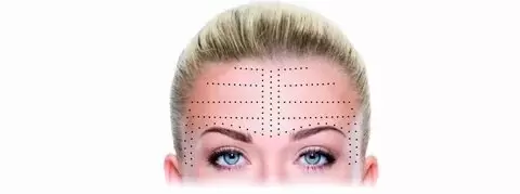 Best Sculptra Injections in frisco