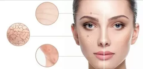 How Long Will the Skin Treatment Take